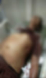 Kasatreskrim Polres Mura Benarkan Anggota PKD Karang Panggung Meninggal 